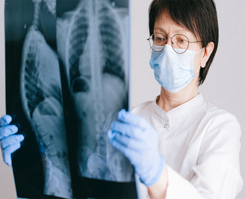 Doctor holding an X-ray image of a spine.