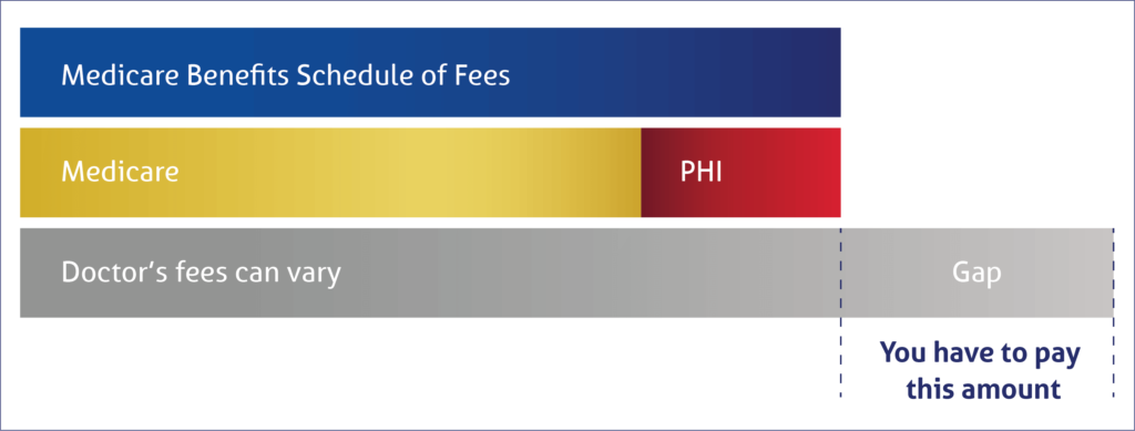 Bar diagram showing three vertical bars, the first representing MBS fees, the second representing the combined MBS fees and Private Health Insurance (PHI) coverage, and the third, taller bar representing doctors' fees, with the gap fee as the difference between doctors' fees and the combined MBS and PHI coverage.